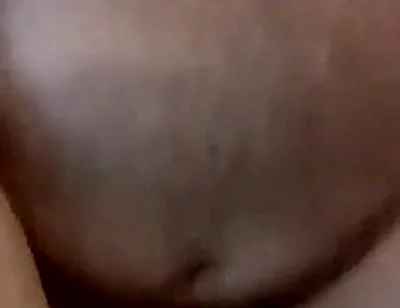 Daddy Saline Glucuse Sack