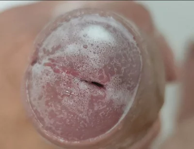 Extreme Burning Sensation Makes the Glans Foam with Arousal.