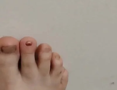 11-26-2025 Cute Little Toes