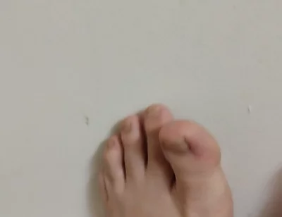 11-26-2025 Cute Little Toes