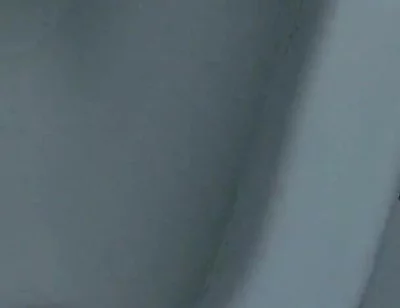 Homemade Method for Freezing the Penis.