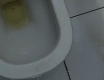 Homemade Method for Freezing the Penis