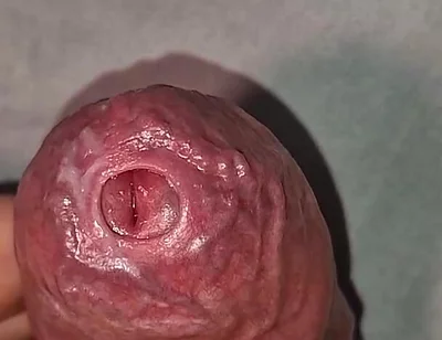 Close up on Phimosis Large Cock, so Hot!