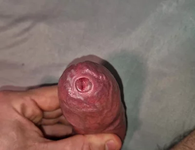 Close up on Phimosis Large Cock, so Hot!