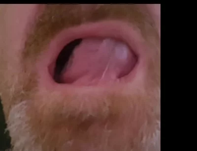 Mature Chubby Bear Toothless. Watch Inside My Toothless Mouth and Meet My Tongue - Mouth Fetish