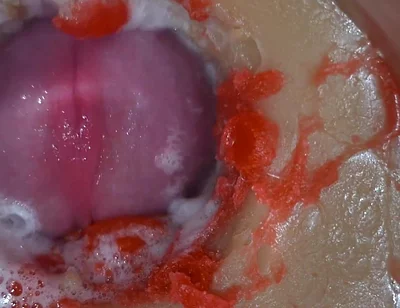 Insemination - Internal Camera Captures Deep Male Ejaculation