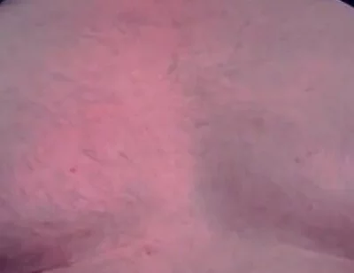 Brust Raus Nippel