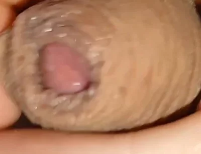Cumshot of the Largest Phimosis Foreskin in the World.